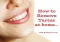 Featured image for Stubborn Tartar Buildup? Powerful Ways to Clean Without the Dentist!