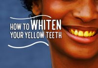 Featured image for Yellow Teeth Got You Down? 5 Affordable Whitening Methods