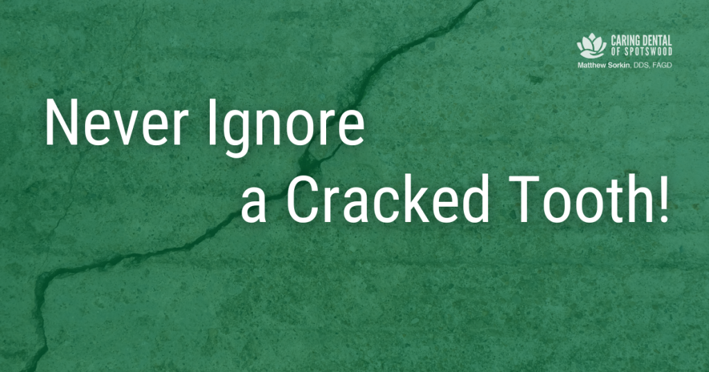 Content image for Cracked Tooth? Don't Ignore! Impacts and Solutions