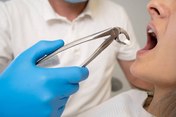 Content image for Impacted Wisdom Teeth? Pain-Free Solutions