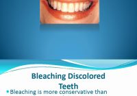 Featured image for Does Bleaching Damage Enamel? Dentist Explains