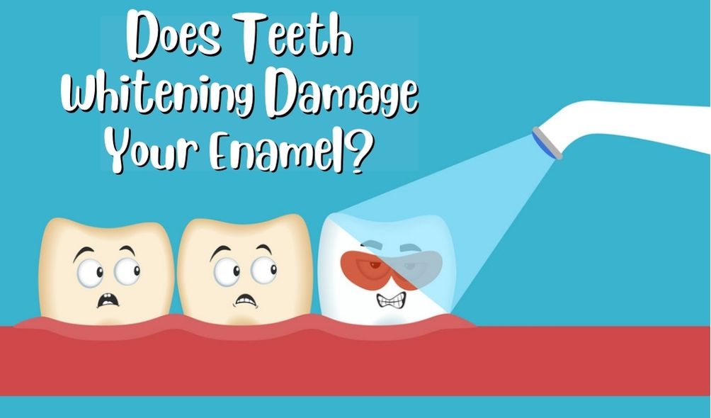 Content image for Does Bleaching Damage Enamel? Dentist Explains