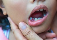Featured image for Baby Teeth Falling Out Due to Calcium Deficiency? The Facts
