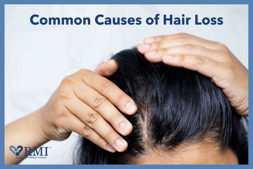 Content image for Hair Loss: 7 Common Causes You Need to Know