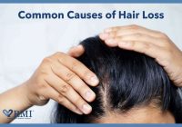 Featured image for Hair Loss Due to Hormones: Causes and Solutions