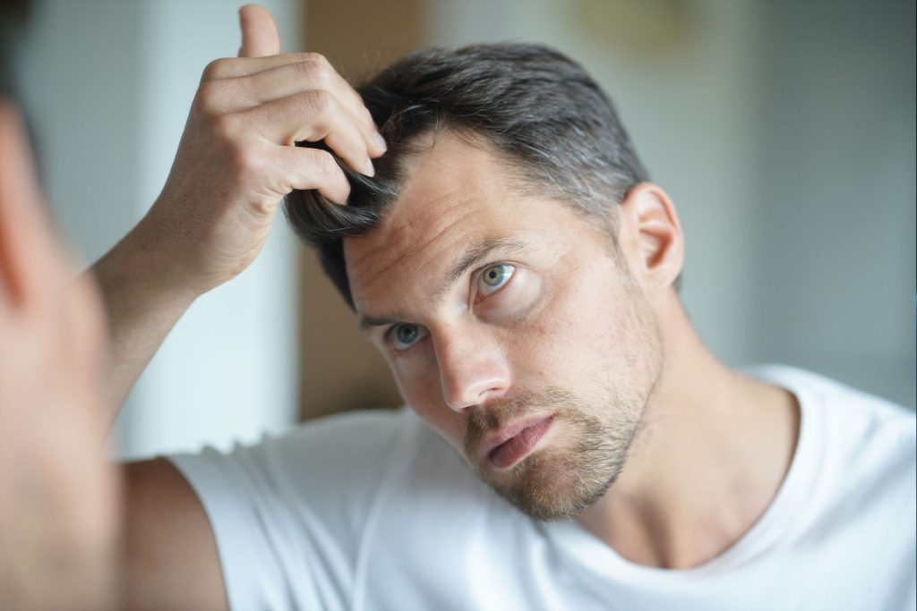 Content image for Hair Loss Due to Hormones: Causes and Solutions