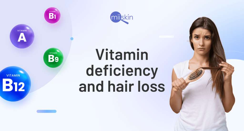 Content image for Hair Loss Due to Nutrient Deficiency: The Right Foods