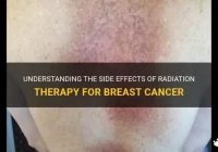 Featured image for Hair Loss Due to Radiation: Treatment Side Effects