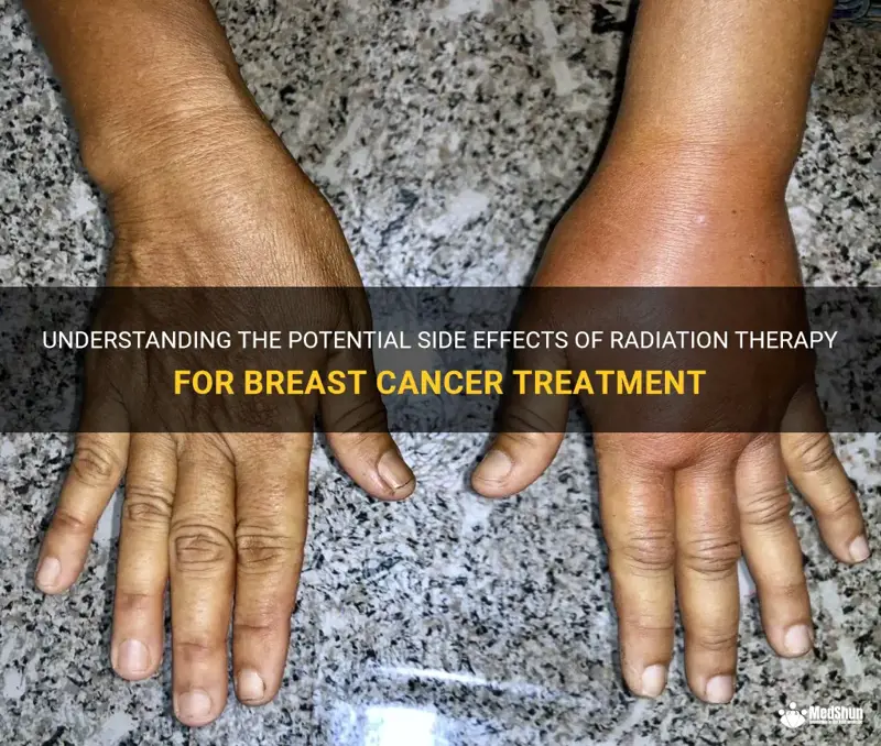 Content image for Hair Loss Due to Radiation: Treatment Side Effects