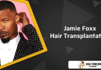 Featured image for Hair Transplantation: Permanent Solution for Baldness