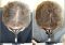 Featured image for Laser Therapy: Hair Treatment with Laser Light