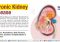 Featured image for Chronic Kidney Disease: Symptoms, Causes, and Therapy Options