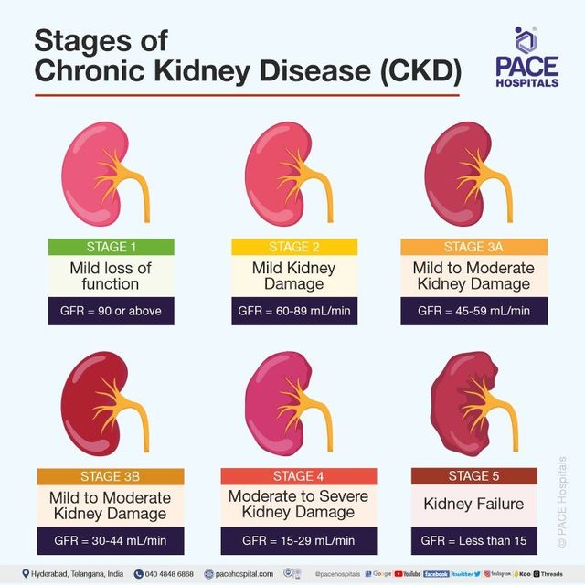 Content image for Chronic Kidney Disease: Symptoms, Causes, and Therapy Options