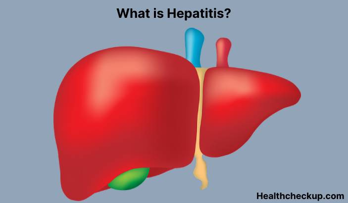 Content image for Hepatitis: Types, Symptoms, and Effective Prevention