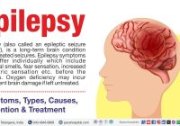 Featured image for Epilepsy: Symptoms, Causes, and Seizure Management