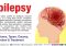 Featured image for Epilepsy: Symptoms, Causes, and Seizure Management
