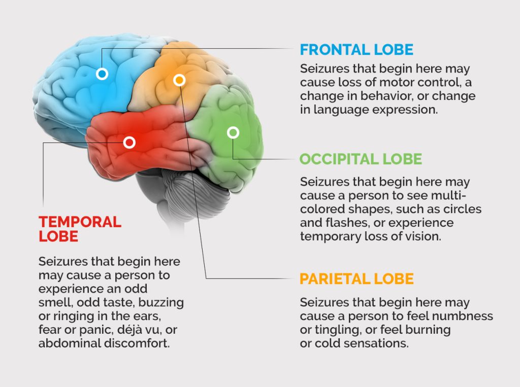 Content image for Epilepsy: Symptoms, Causes, and Seizure Management